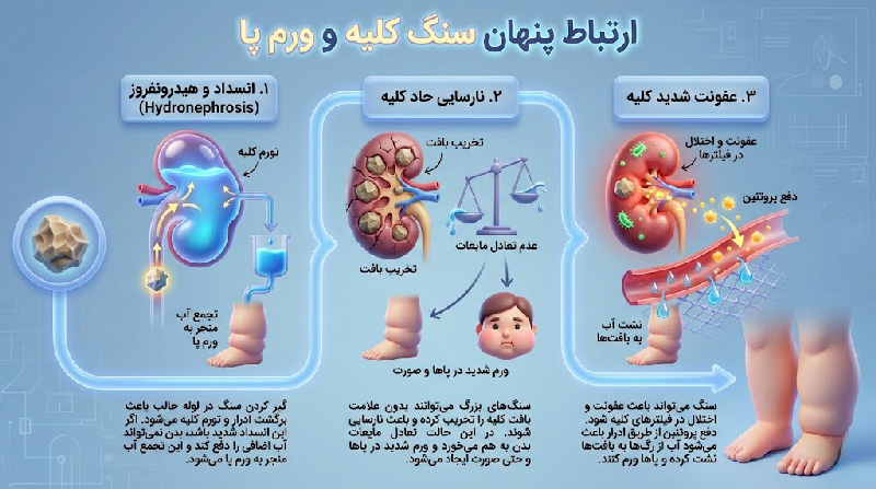 ارتباط پنهان سنگ کلیه و ورم پا | مطب ۳۶۵