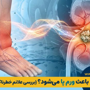 آیا سنگ کلیه باعث ورم پا می‌شود؟ | مطب ۳۶۵