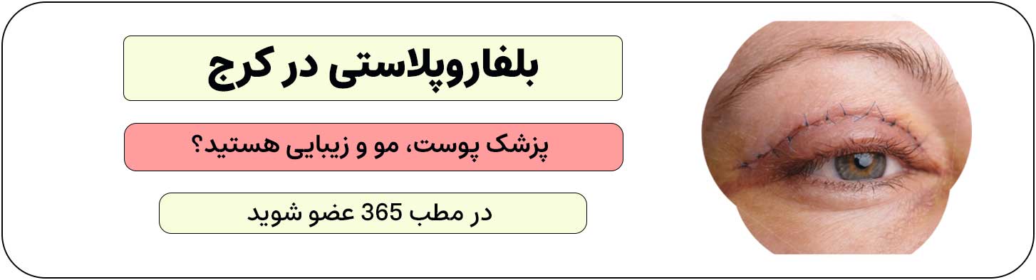 ثبت نام متخصص زیبایی، پوست و مو برای انجام خدمات بلفاروپلاستی در کرج