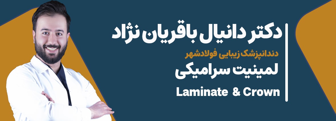 لمینت سرامیکی در فولادشهر