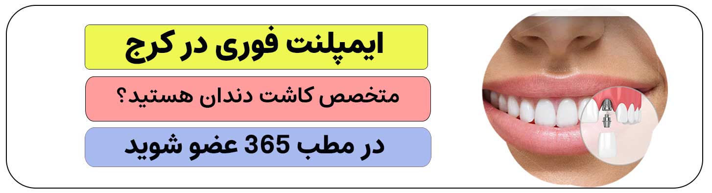 جهت ثبت نام برای انجام دادن ایمپلنت فوری در کرج کلیک کنید