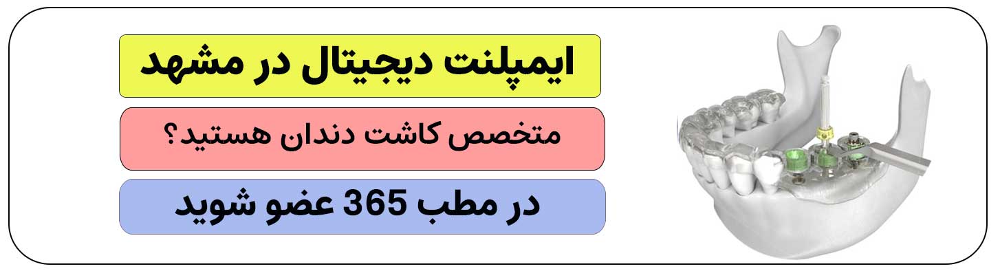 اگر ایمپلنت دیجیتال در مشهد انجام می دهید، ثبت نام کنید