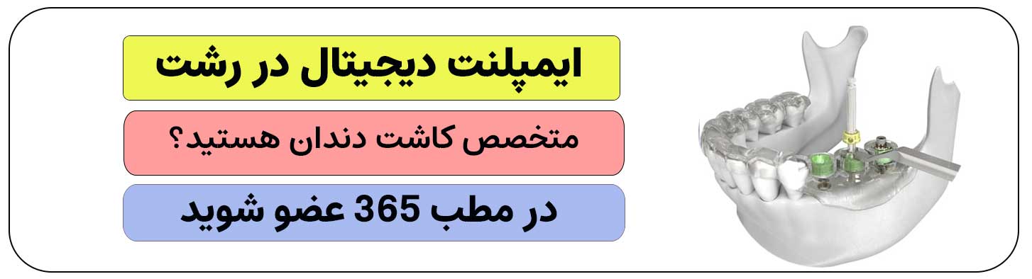 اگر ایمپلنت دیجیتال در رشت انجام می دهید، ثبت نام کنید