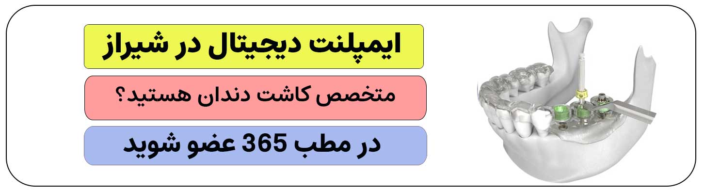 برای ثبت نام ایمپلنت دیجیتال در شیراز کلیک کنید