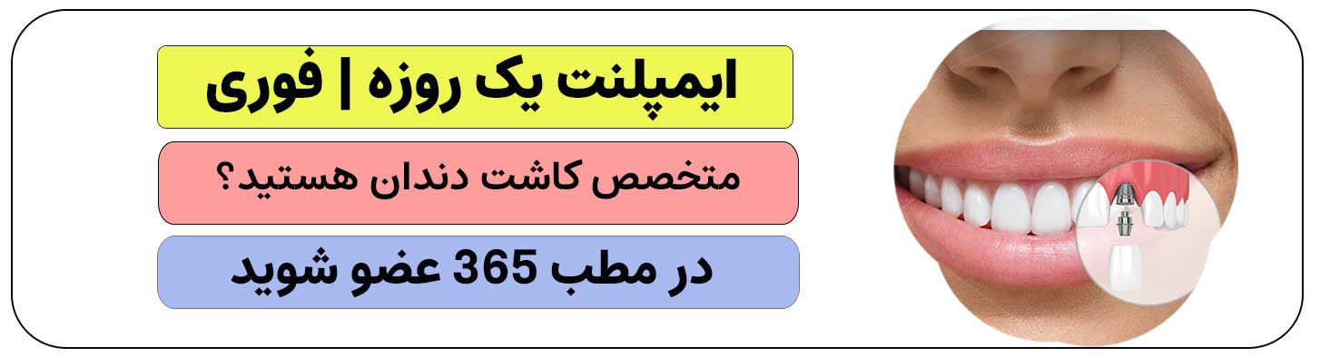 برای انجام خدمات ایمپلنت یک روزه| فوری ثبت نام کنید