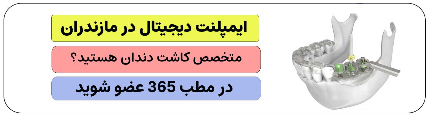 اگر ایمپلنت دیجیتال در مازندران انجام می دهید ثبت نام کنید