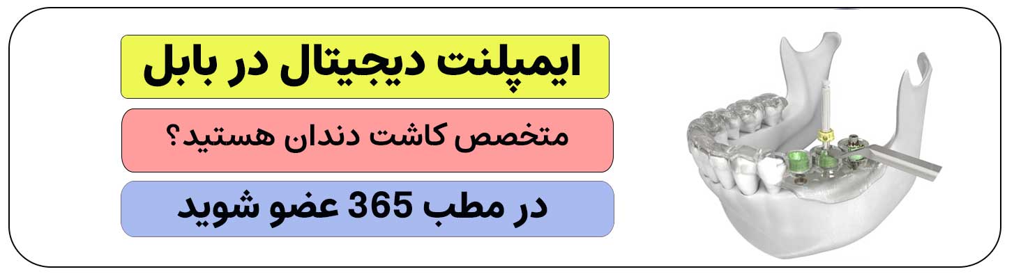 اگر ایمپلنت دیجیتال در بابل انجام می دهید، ثبت نام کنید