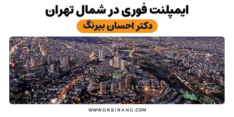 ایمپلنت فوری در شمال تهران