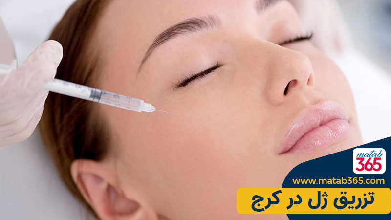 تزریق ژل در کرج