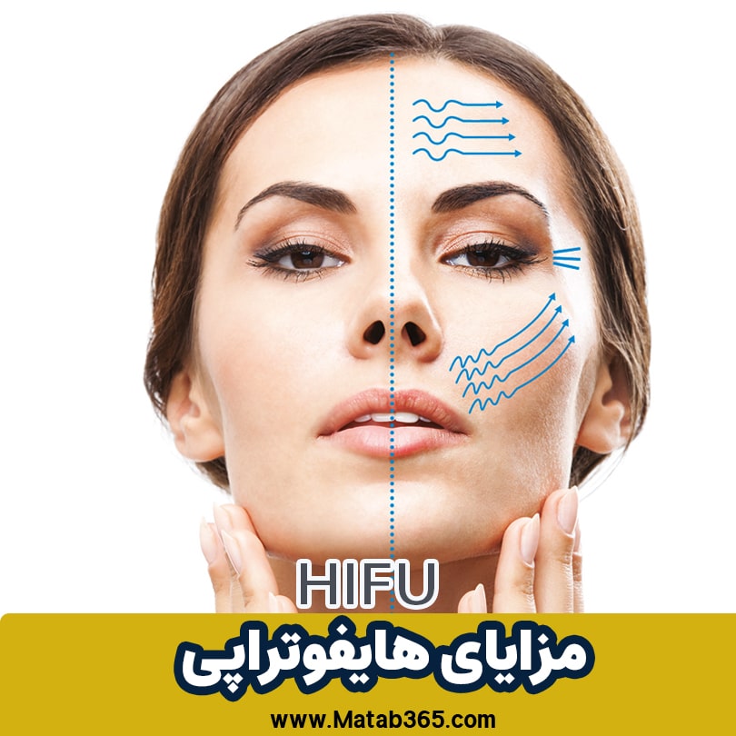 مزایای هایفوتراپی