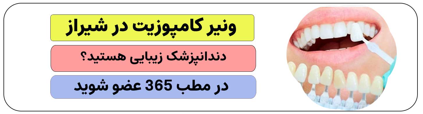 ثبت نام متخصص و دندانپزشک زیبایی برای ونیرکامپوزیت در شیراز