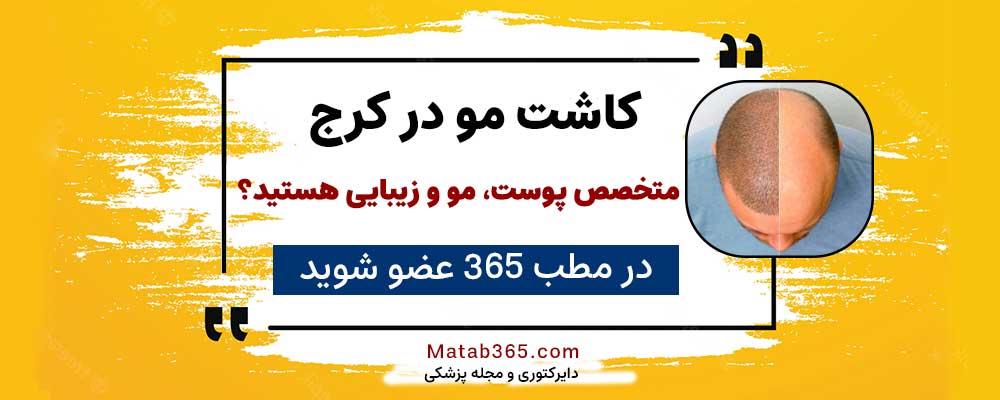 برای ثبت نام جهت انجام کاشت مو در کرج کلیک کنید