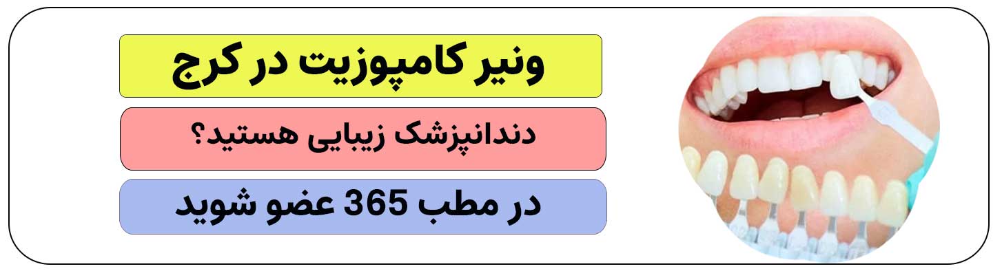 ثبت نام متخصص و دندانپزشک زیبایی برای ونیرکامپوزیت در کرج