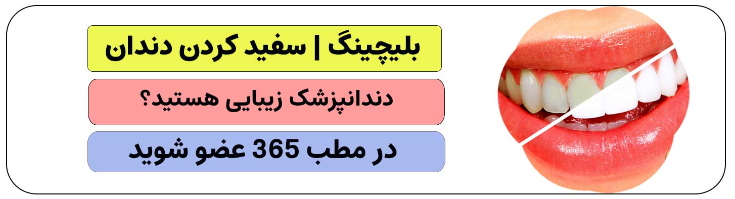 برای انجام بلیچینگ دندان ثبت نام کنید