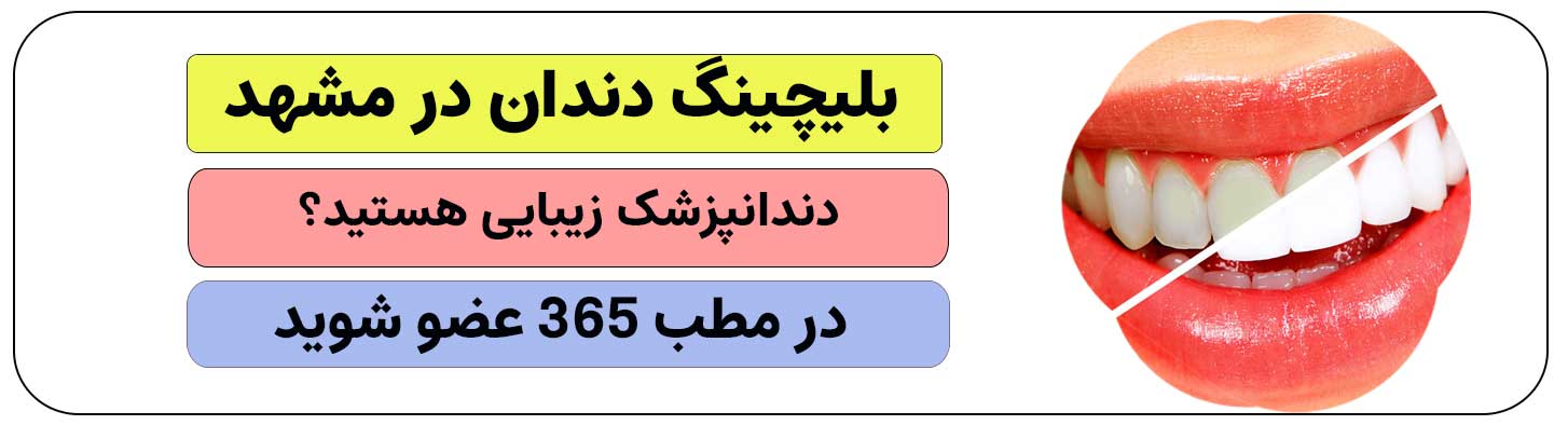 برای انجام بلیچینگ دندان در مشهد ثبت نام کنید