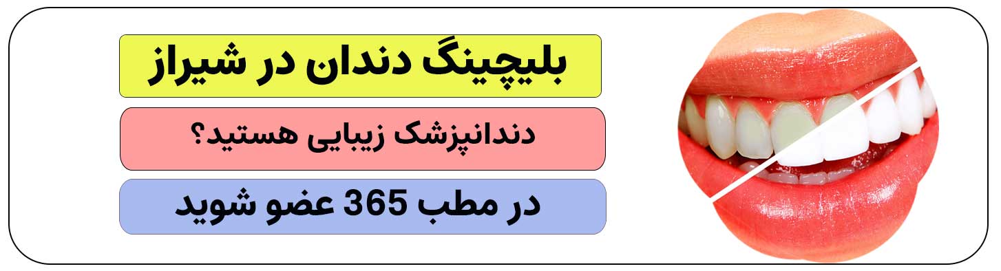 برای انجام بلیچینگ دندان در شیراز ثبت نام کنید