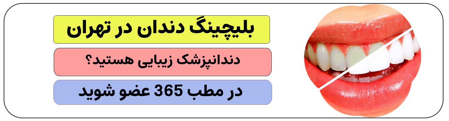 برای انجام بلیچینگ دندان در تهران ثبت نام کنید