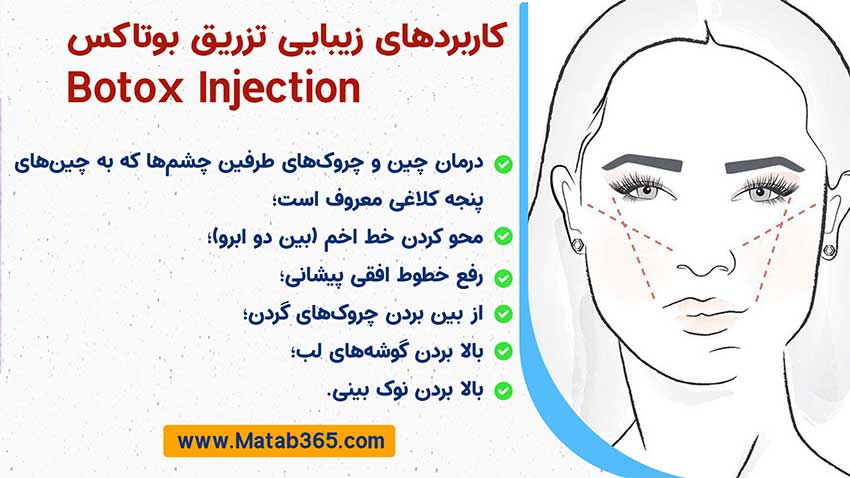 برندهای معتبر بوتاکس در شهرکرد