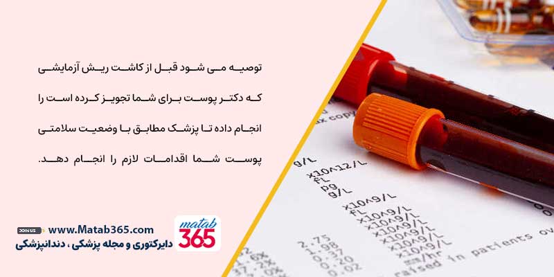 انجام آزمایش و چکاب قبل از کاشت ریش