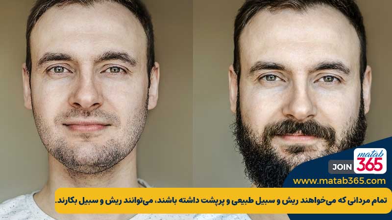 افراد مناسب برای کاشت ریش