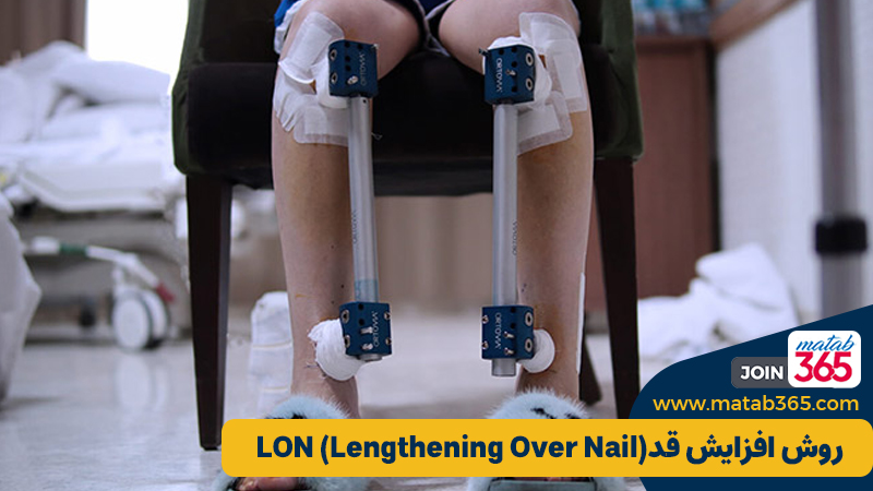 روش افزایش قد LON