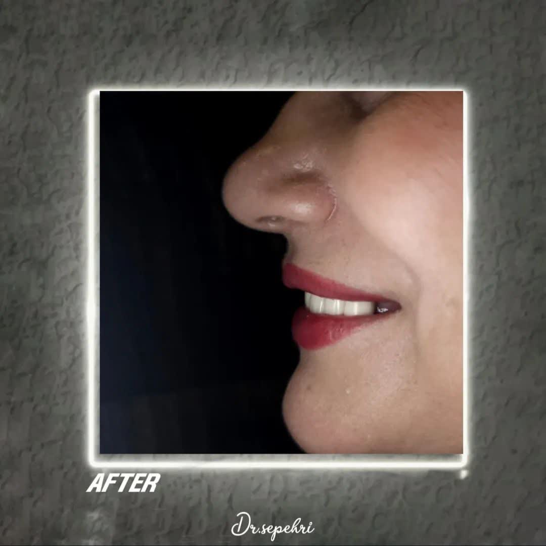 نمونه کار دکتر احمدرضا سپهری | مطب ۳۶۵