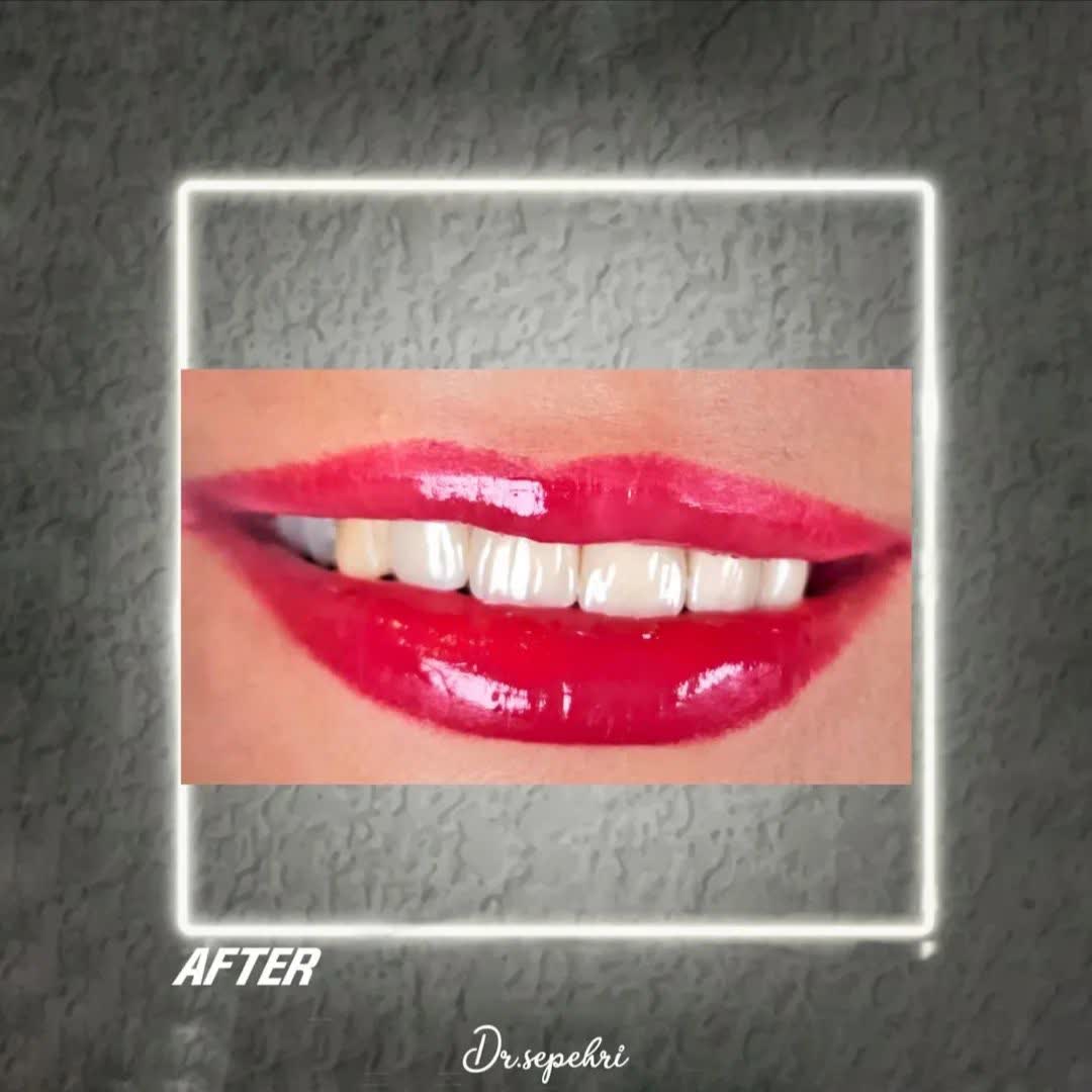 نمونه کار دکتر احمدرضا سپهری | مطب ۳۶۵