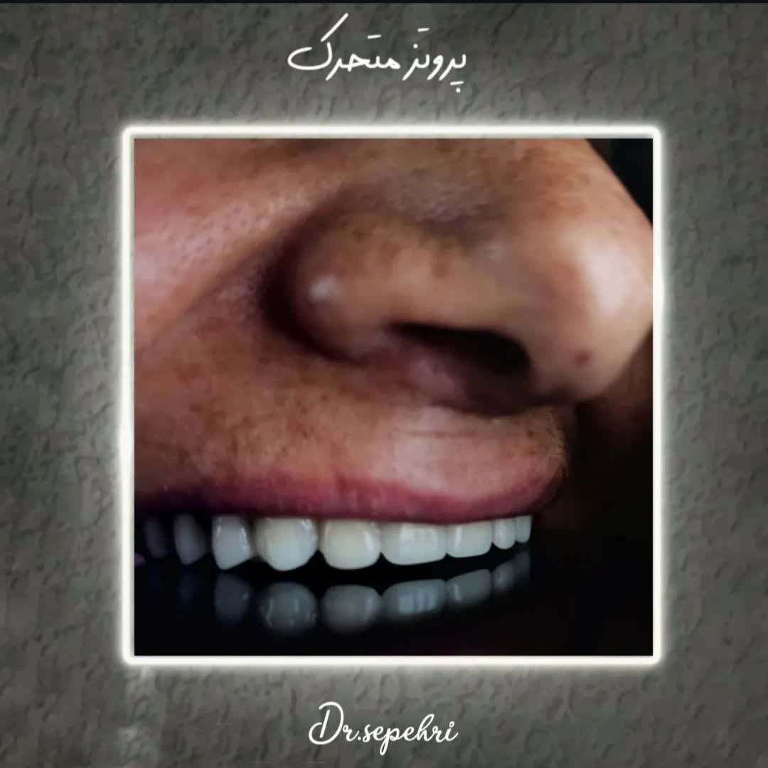 نمونه کار دکتر احمدرضا سپهری | مطب ۳۶۵