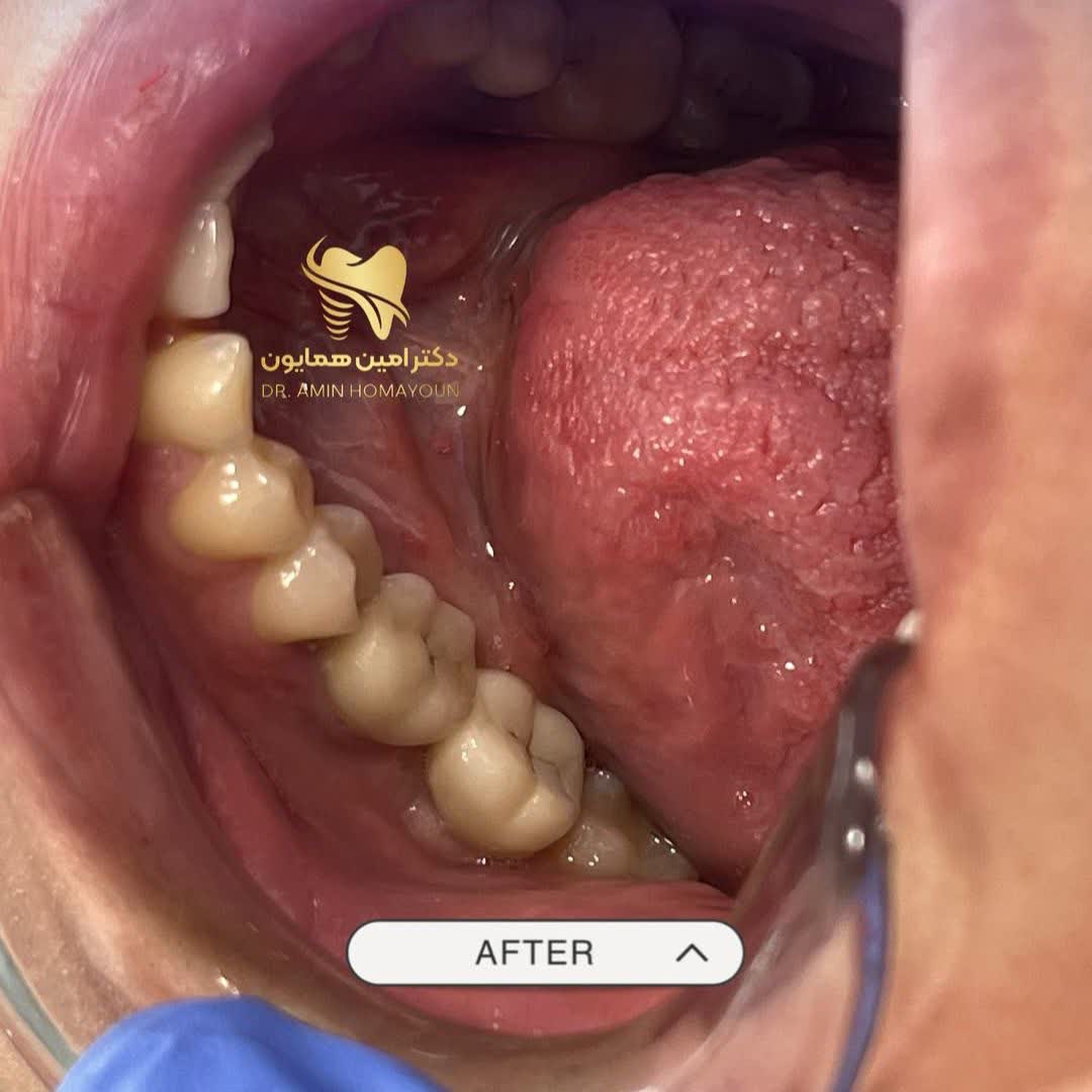 نمونه کار دکتر امین همایون | مطب 365