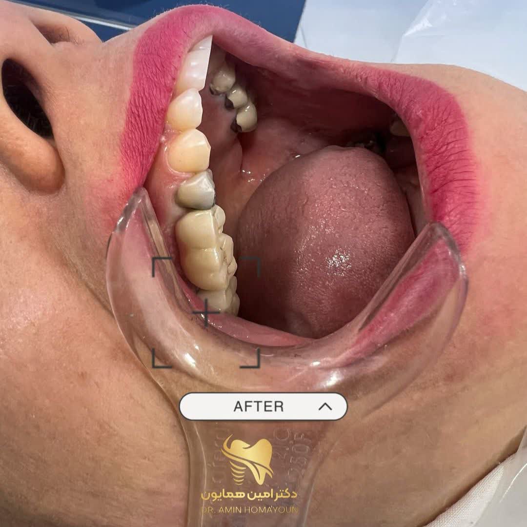 نمونه کار دکتر امین همایون | مطب 365