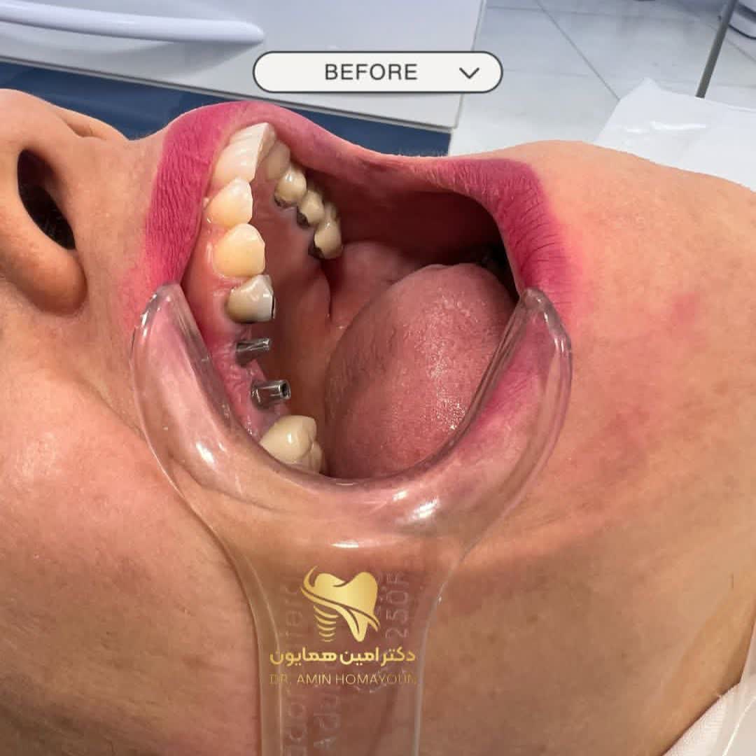 نمونه کار دکتر امین همایون | مطب 365