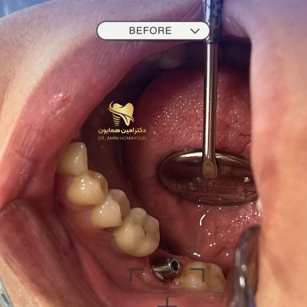 نمونه کار دکتر امین همایون | مطب 365