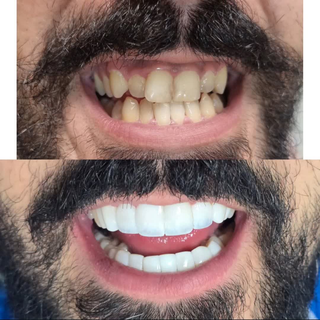 نمونه کارهای دکتر آنا دهقانی | مطب ۳۶۵