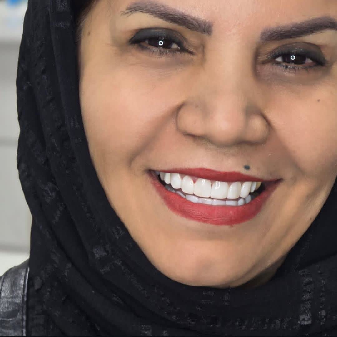 نمونه کارهای دکتر آنا دهقانی | مطب ۳۶۵