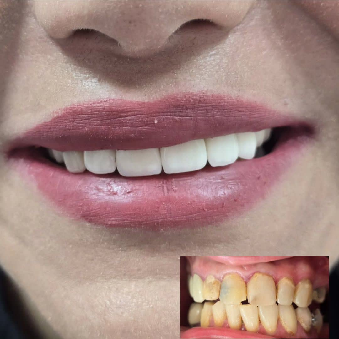 نمونه کارهای دکتر آنا دهقانی | مطب ۳۶۵