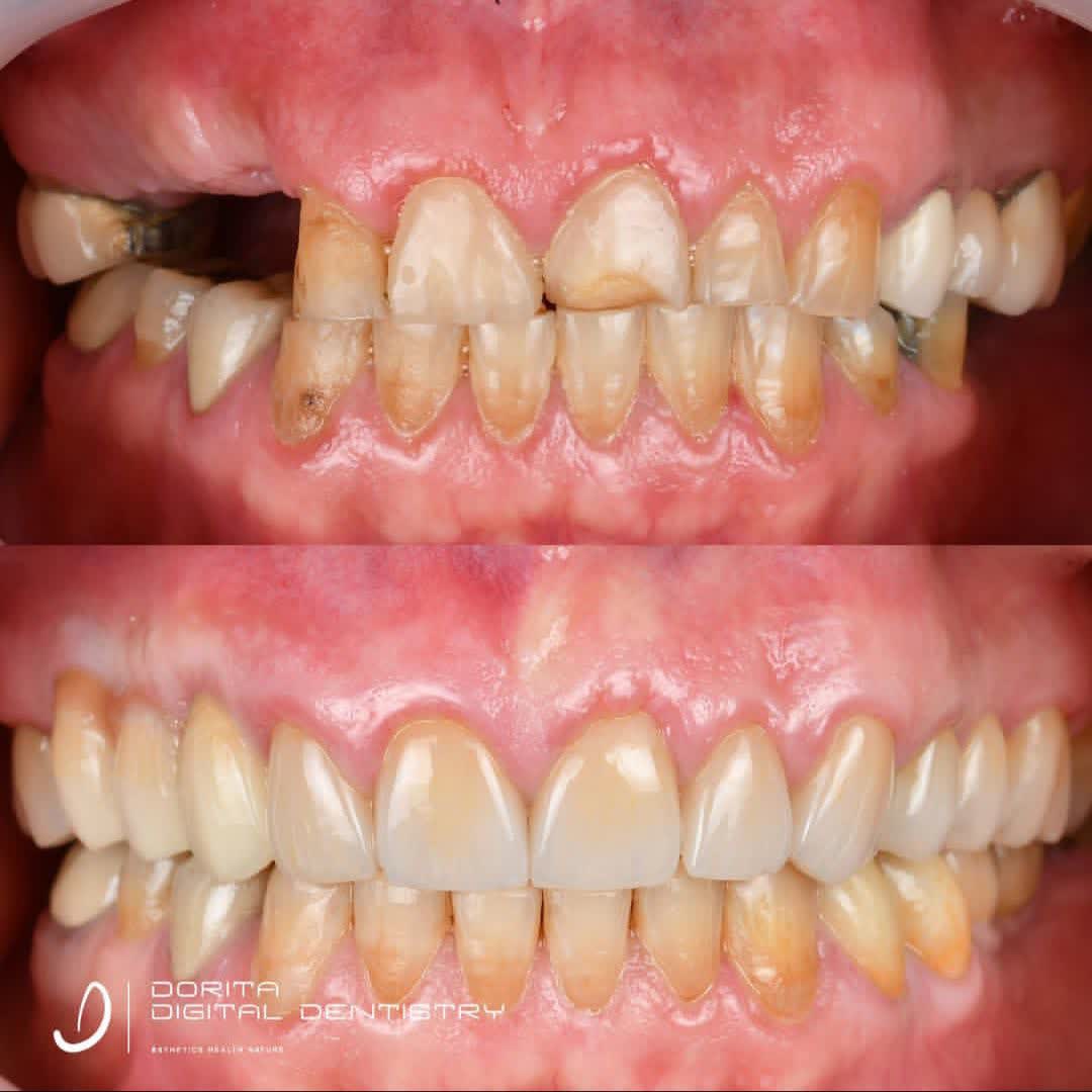 نمونه کار دکتر فرانک وکیلی | مطب ۳۶۵