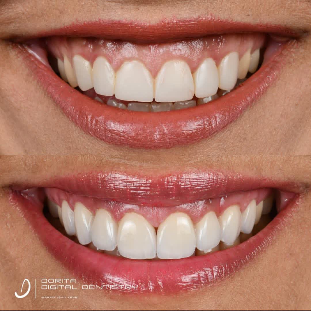 نمونه کار دکتر فرانک وکیلی | مطب ۳۶۵