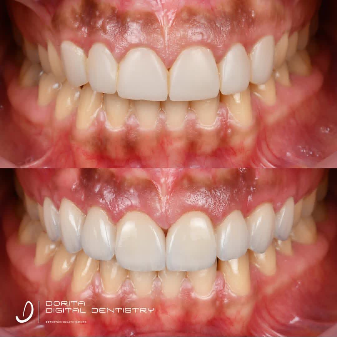 نمونه کار دکتر فرانک وکیلی | مطب ۳۶۵