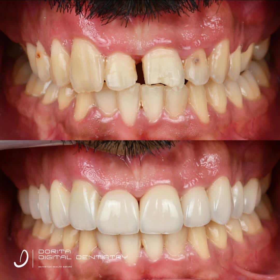 نمونه کار دکتر فرانک وکیلی | مطب ۳۶۵