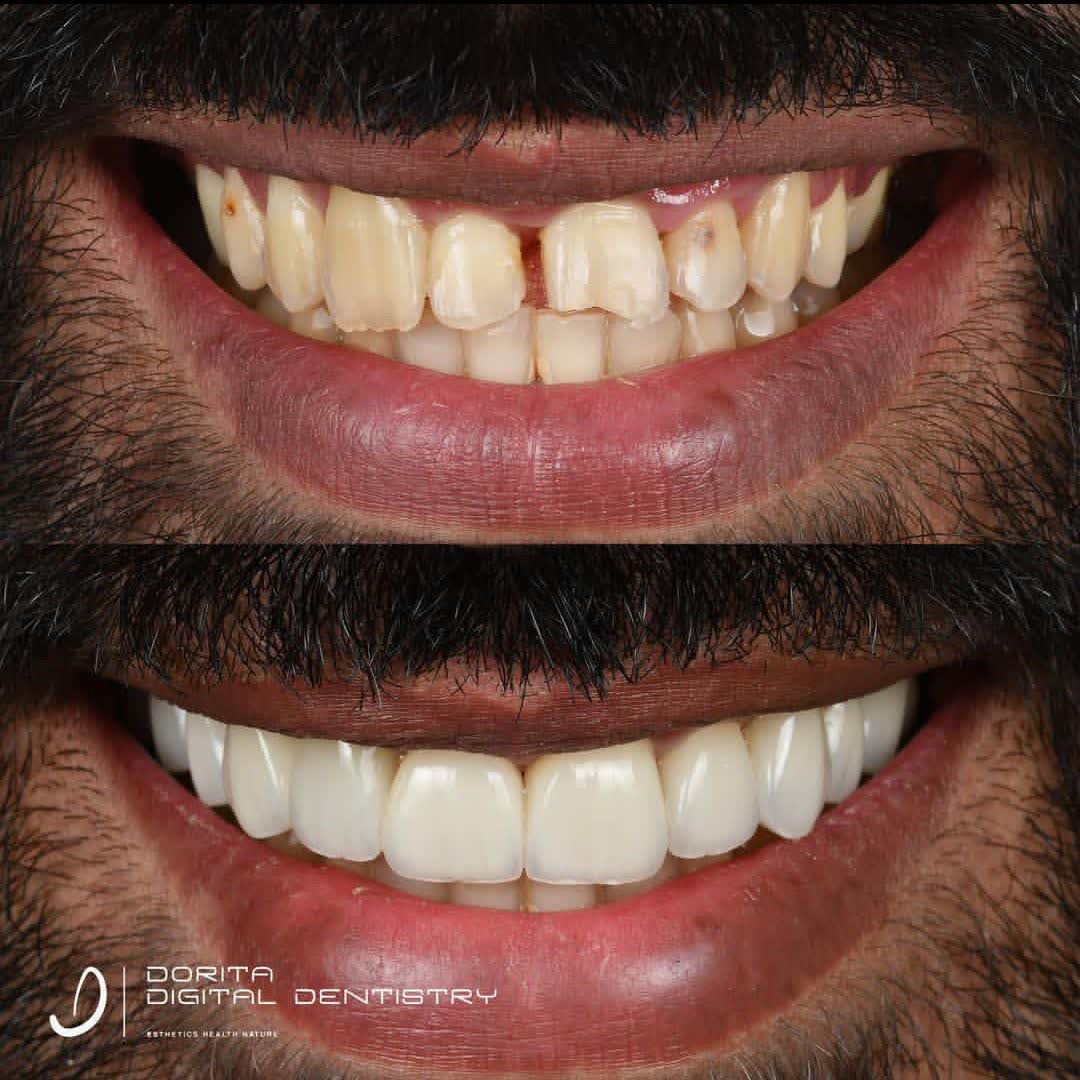 نمونه کار دکتر فرانک وکیلی | مطب ۳۶۵