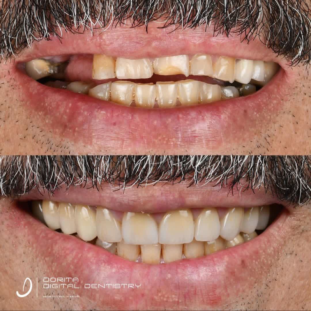 نمونه کار دکتر فرانک وکیلی | مطب ۳۶۵