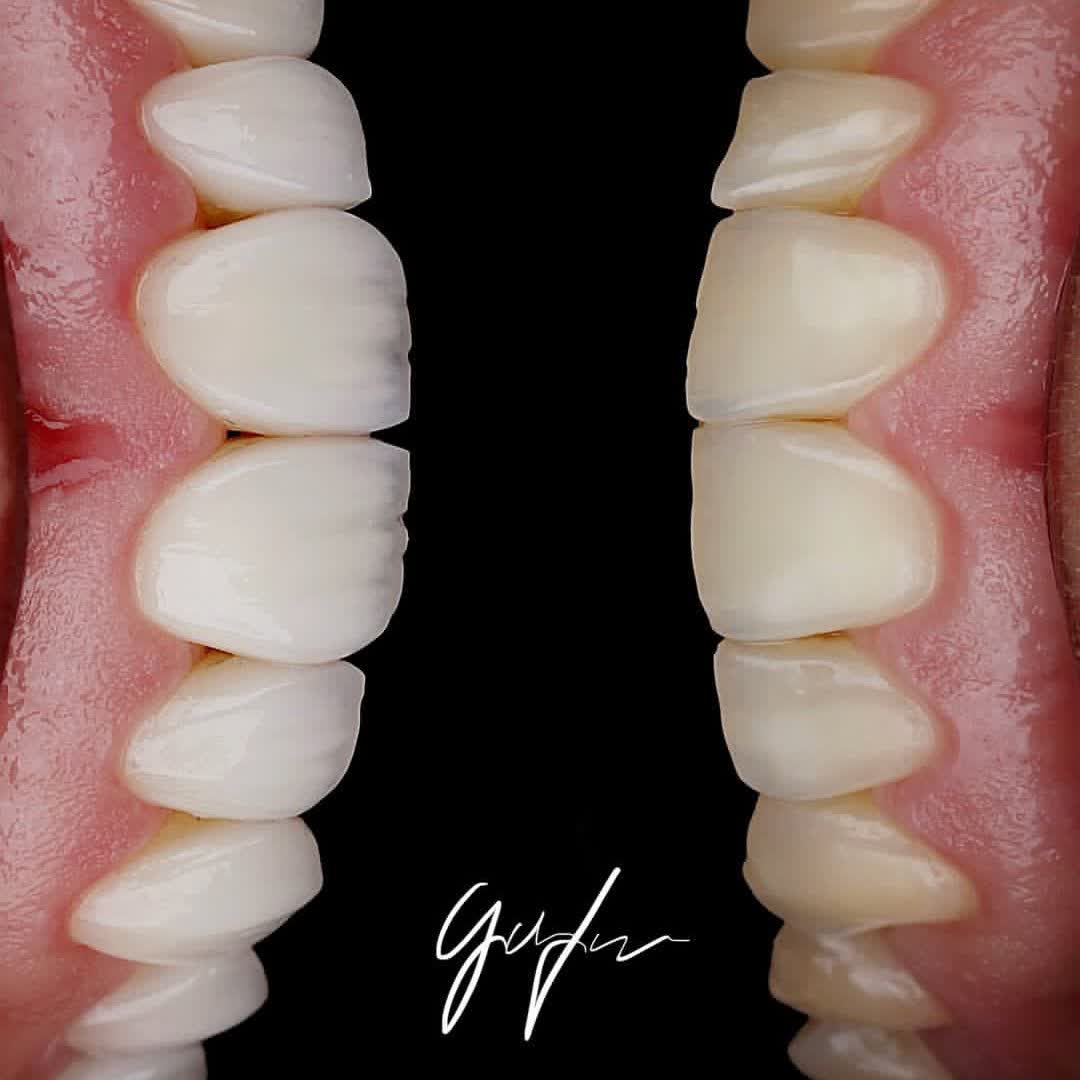 نمونه کار دکتر حسین تقوی | مطب 365