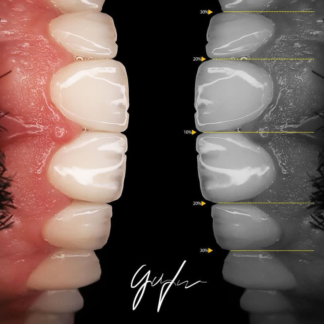 نمونه کار دکتر حسین تقوی | مطب 365