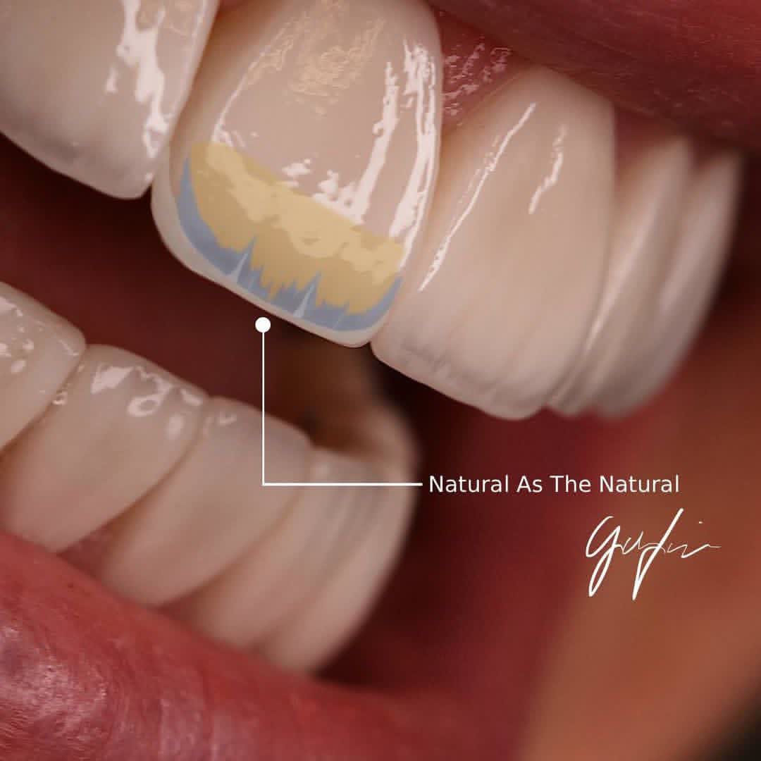 نمونه کار دکتر حسین تقوی | مطب 365