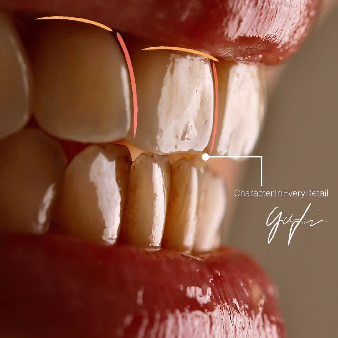 نمونه کار دکتر حسین تقوی | مطب 365