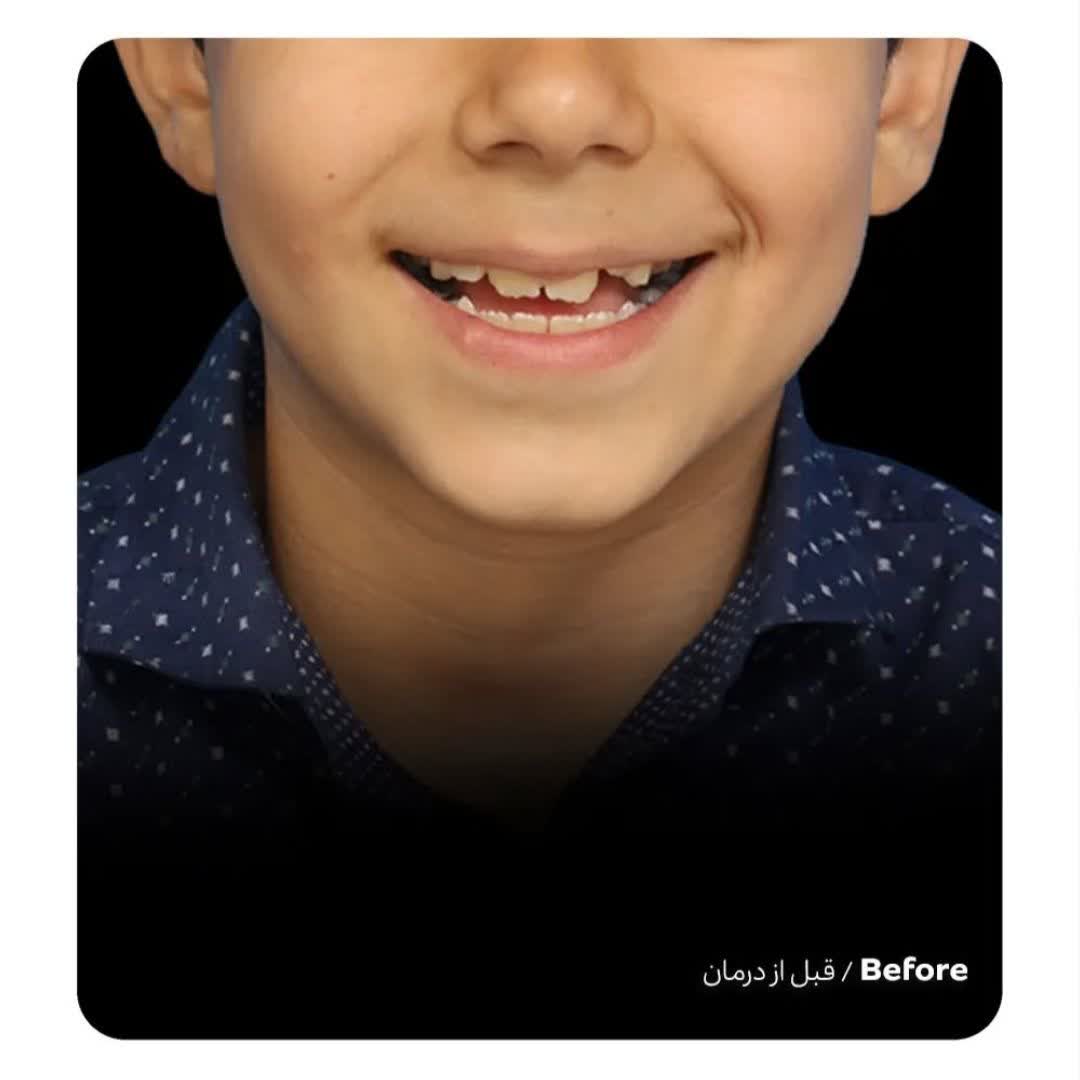 نمونه کار دکتر مهتاب ابراهیمی نژاد | مطب 365