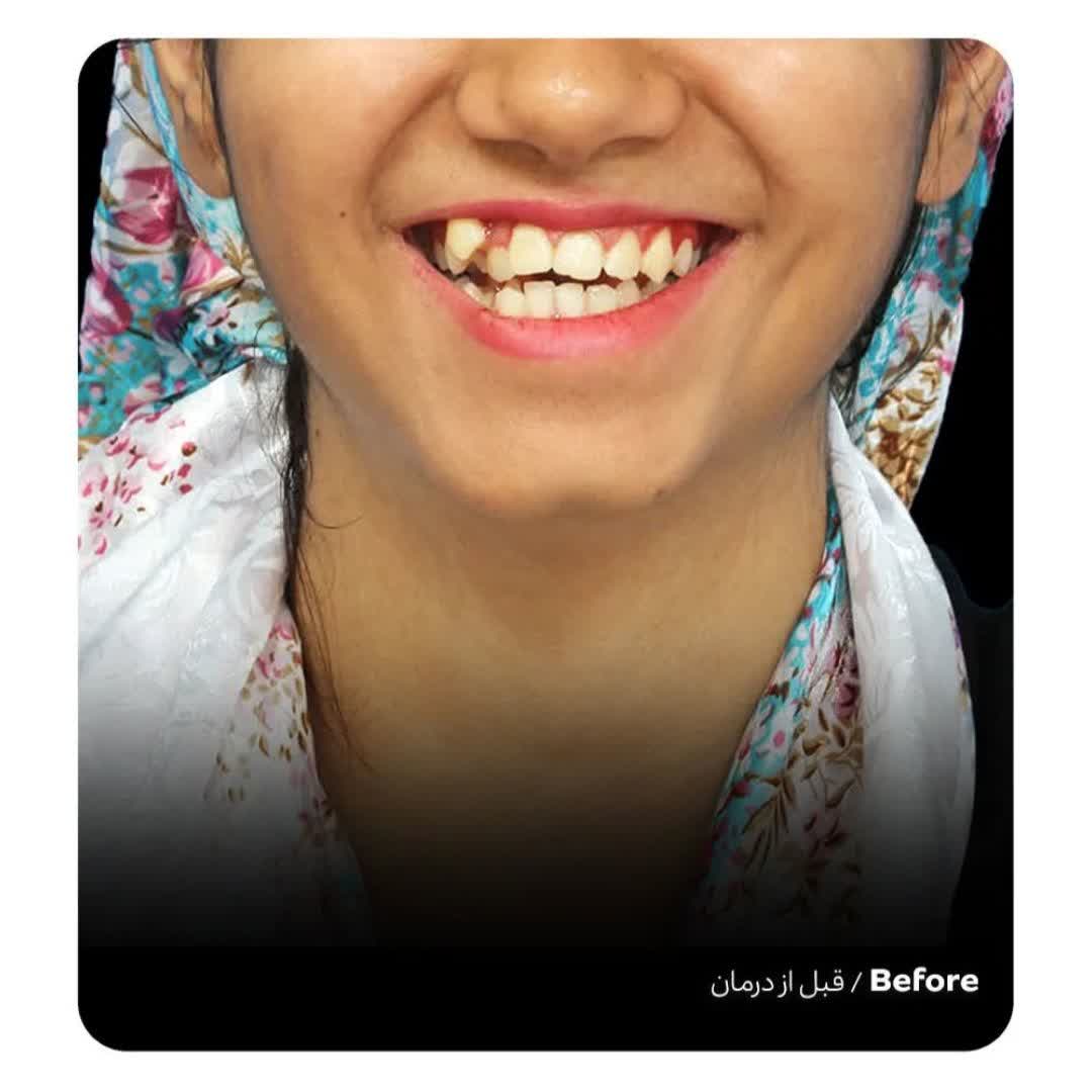 نمونه کار دکتر مهتاب ابراهیمی نژاد | مطب 365