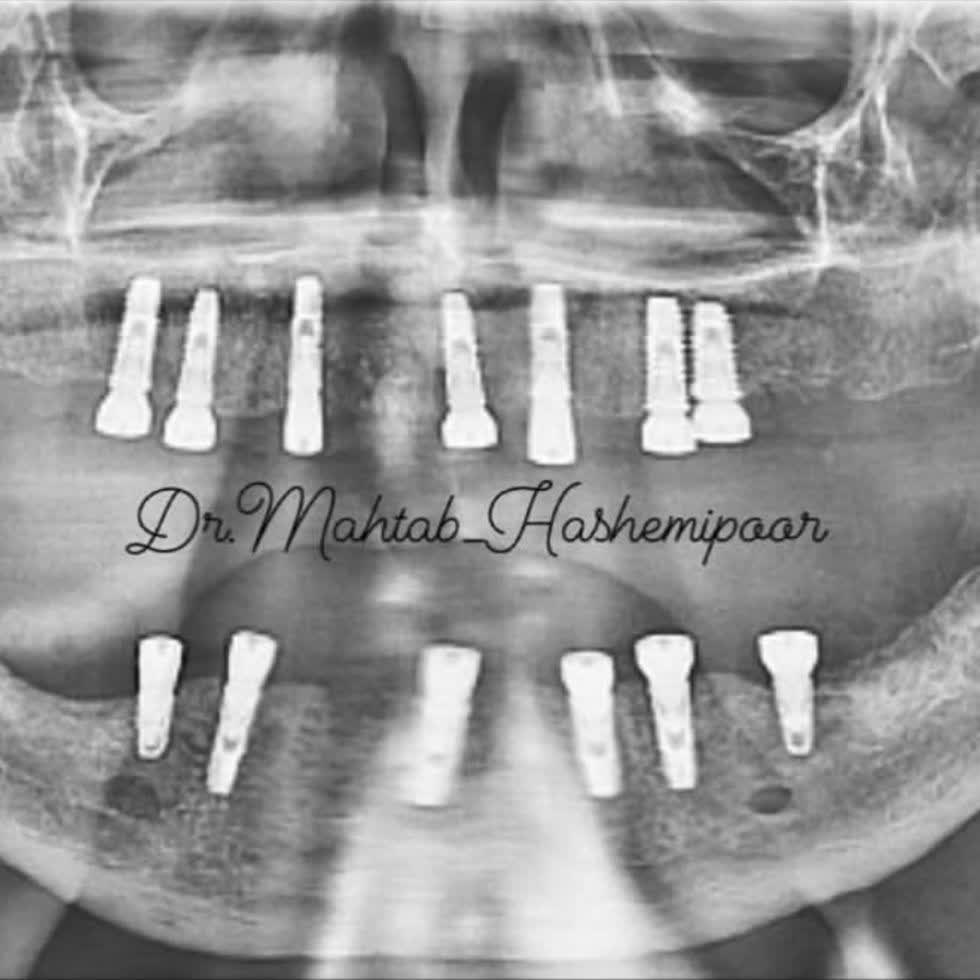 نمونه کار دکتر مهتاب سادات هاشمی پور | مطب ۳۶۵