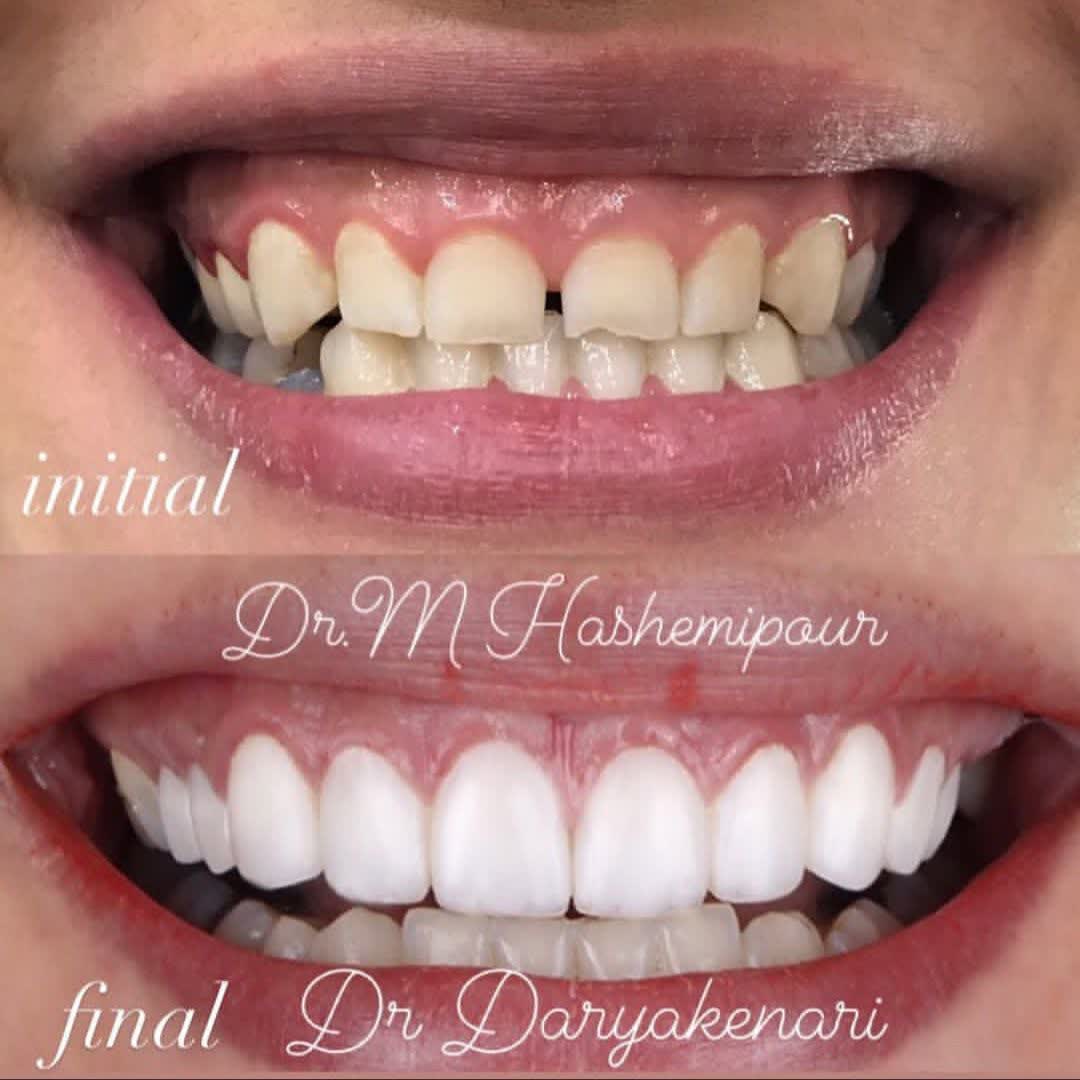 نمونه کار دکتر مهتاب سادات هاشمی پور | مطب ۳۶۵