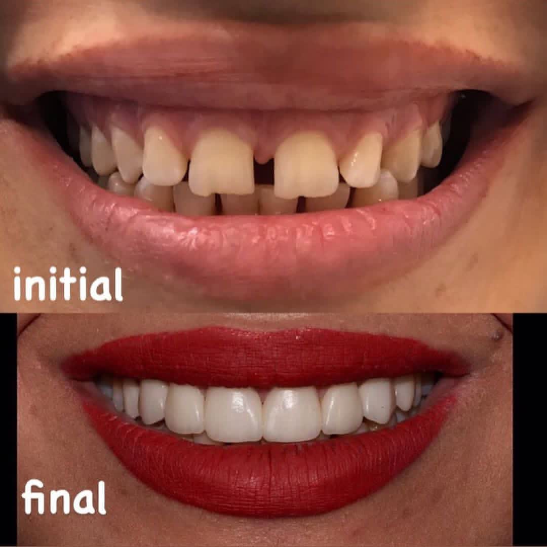 نمونه کار دکتر مهتاب سادات هاشمی پور | مطب ۳۶۵